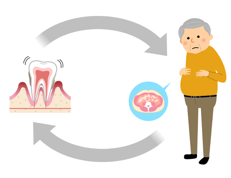 歯周病とメタボリックシンドローム