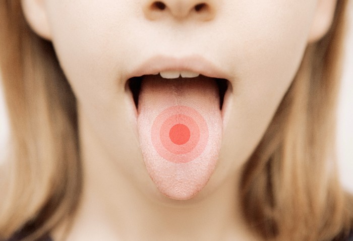 舌 癌 喉 の 痛み