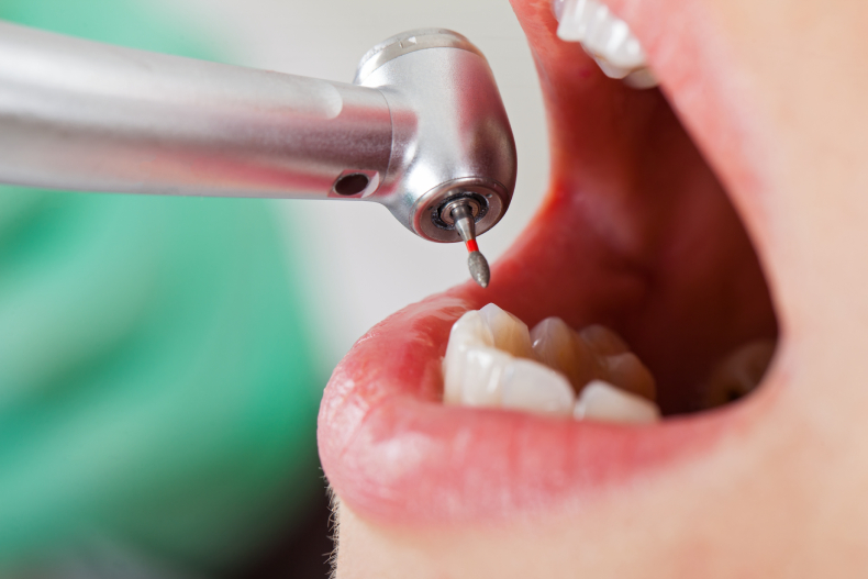 初期の虫歯でも放置は危険！？放置したらどうなるの？