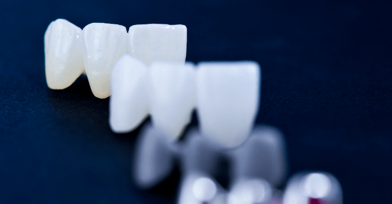 セラミック　歯の形